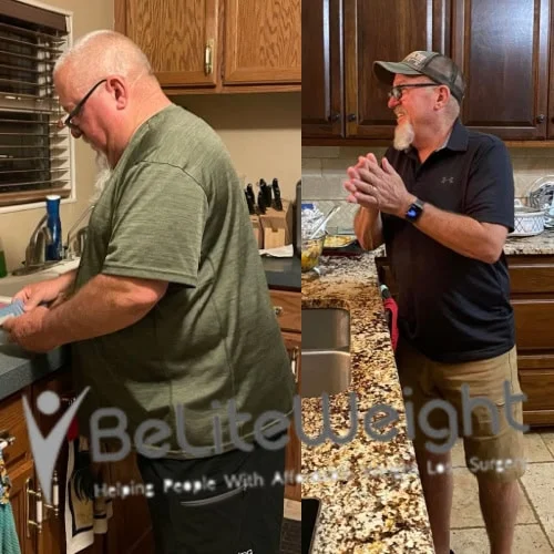 Weight Loss Surgery Before And After